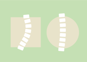 どのぐらい良くなる!?『側弯手術の矯正率』